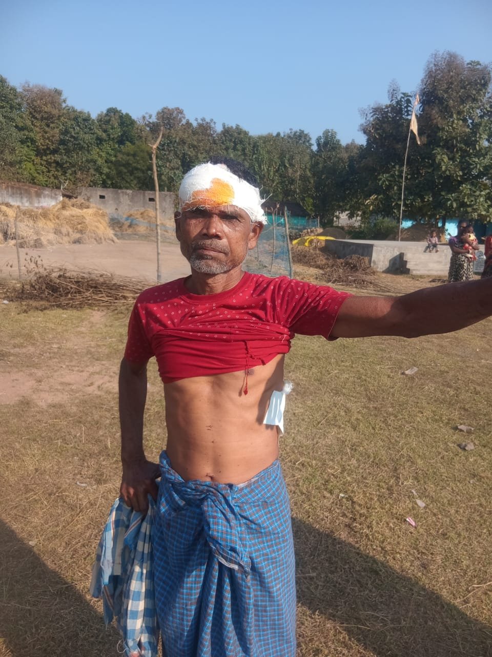 घायल पुरुष