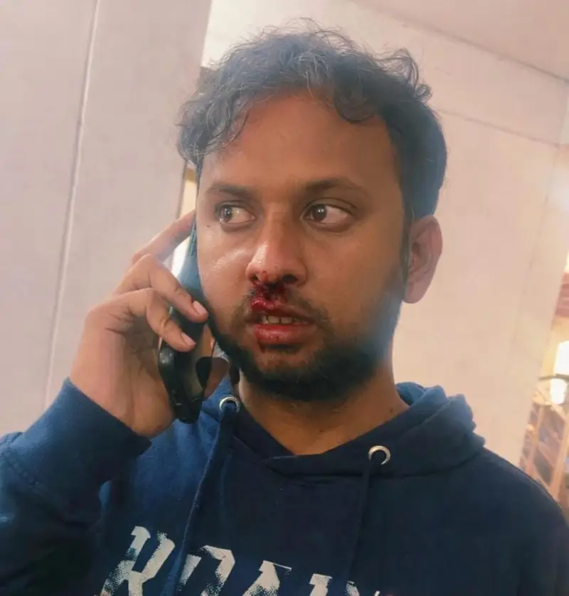 घायल पत्रकार अंकित शुभम