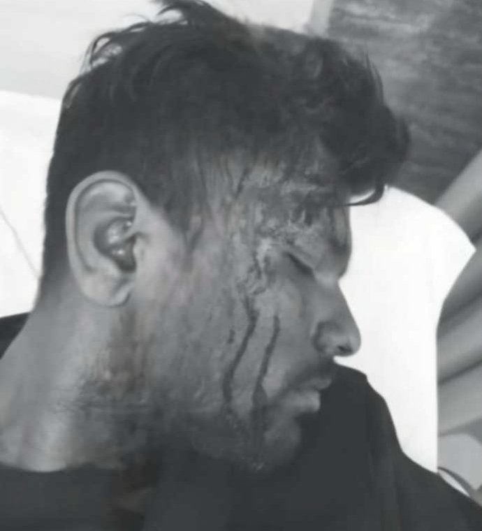 सरस्वती पूजा के विसर्जन के दौरान मारपीट में घायल युवक