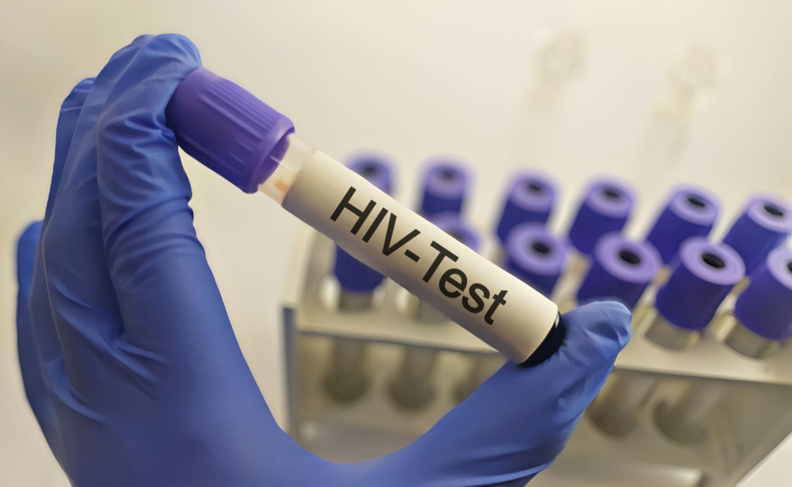 चाईबासा HIV ब्लड केस